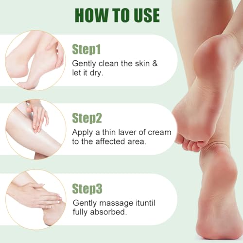 Generic Urea Cream 60% plus 2% Salicylic Acid for Feet – Maximum Strength Foot Cream For Dry, Cracked Heels and Calluses. Deeply Exfoliates Dead skin & Moisturizes, Repairs Rough Feet – 6.35 oz