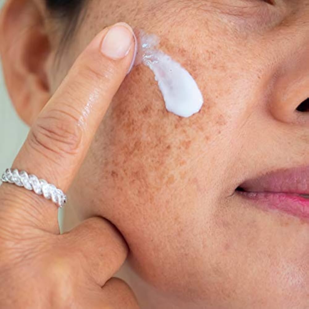 Amazon.com: Skinuva® Brite Dark Spot Treatment - Crema para mejorar el tono  - Corrector de manchas de la edad - Formulado con tecnología de factor de  crecimiento - Adecuado para todo tipo