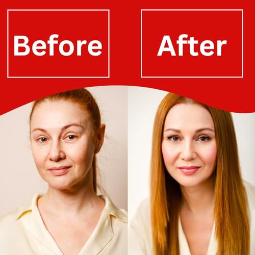 Image of Retinol Pro Night Cream 0.05% Vitamin A Advanced Anti-Aging Moisturizer for Face Fine Lines Wrinkles Sun Spots Uneven Skin Tone 30 g 1.05 oz