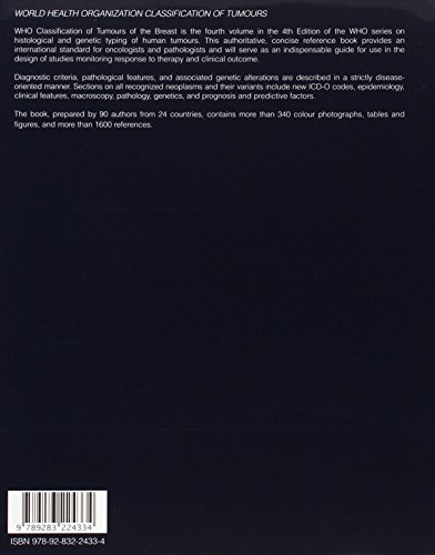 WHO Classification of Tumours of the Breast