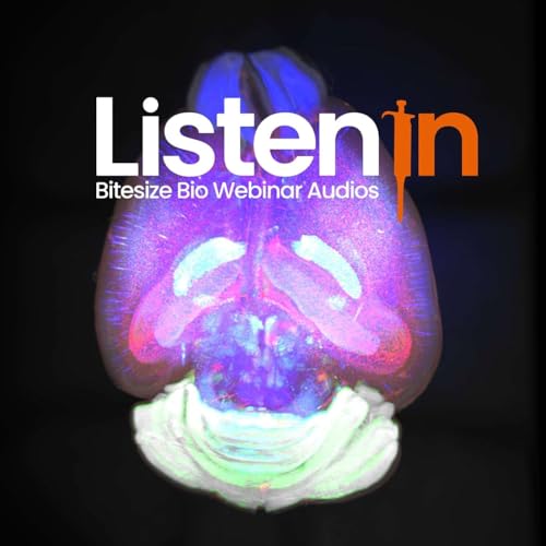 Whole-brain Spatial Transcriptomics at Cellular Resolution