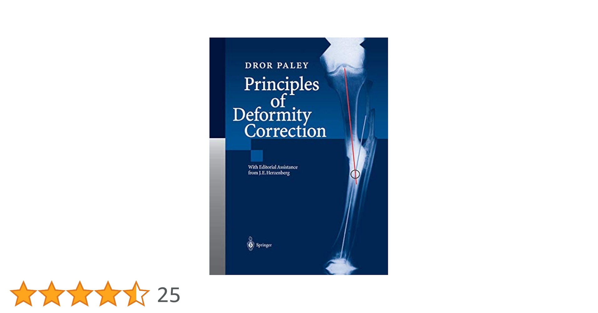 語学・辞書・学習参考書 principles of deformity correction 語学・辞書・学習参考書 principles of deformity correction