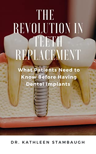 The Revolution in Teeth Replacement: What Patients Need to Know Before Having Dental Implants
