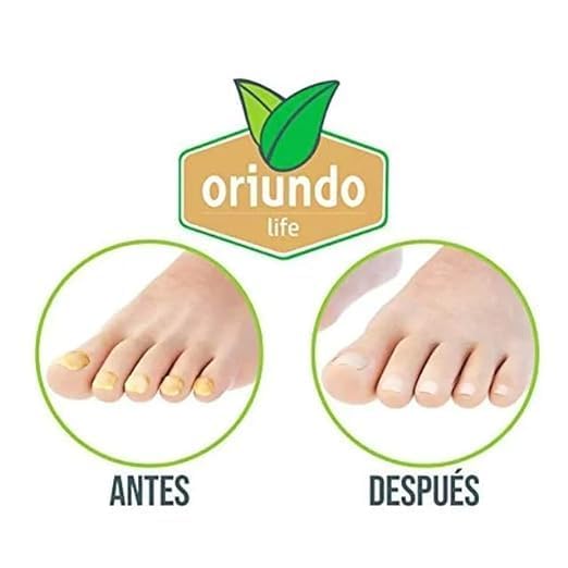 Miniatura 3 de Tratamiento Natural para Uñas Oriundo.  Tratamiento Natural para unas.