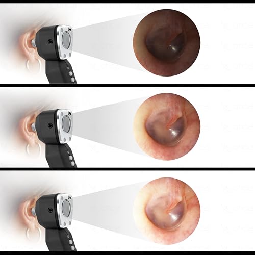 Image of OTICA 3.7V Professional Diagnostic Pocket LED Otoscope | Rechargeable In-Built 3500mAh Battery | Type-C Charging | Adjustable Intensity | 10 Reusable Specula + Spare Glass | 11707 - Black