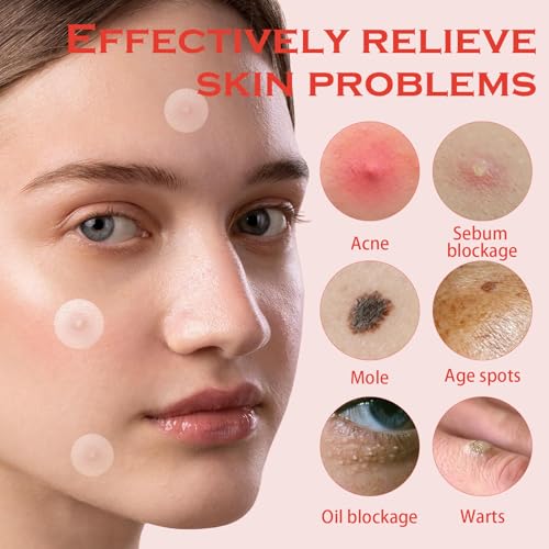 SHUOHONG 144 Stück Pickel Patch Pflaster mit Teebaumöl, Unsichtbarer und Wasserdicht Absorptions Akne Pimple Patches, Hydrokolloid Pflaster, Gesichtsaufkleber, MicroDarts fur Alle Hauttypen