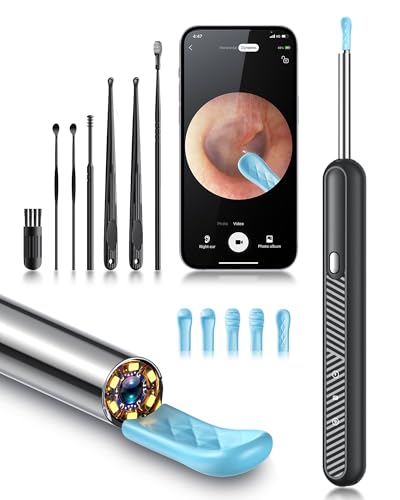 Loyker Ear Wax Removal Tool Camera, Ear Cleaner Only $9.99 at Amazon