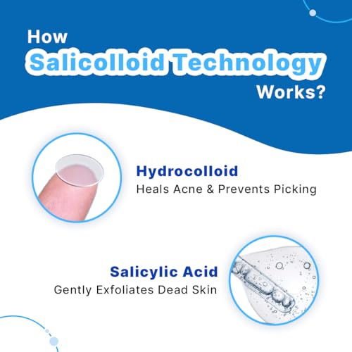 Image of Sotrue Acne Pimple Patches For Face | For Active Surface Acne | Hydrocolloid Waterproof Patches | Absorbs Pimple Overnight, Reduces Excess Oil | Suits All Skin Types (54 Patches)