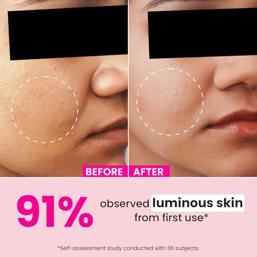 Image of Dot & Key Watermelon 10% Glycolic Serum for Face Glowing, With Kojic, Hyaluronic, Exfoliating | Targets Pigmentation & Dark Spots | Targets Dullness, Uneven Texture, Sebum & Excess Oil | Serum For Oily & Normal Skin | 30ml