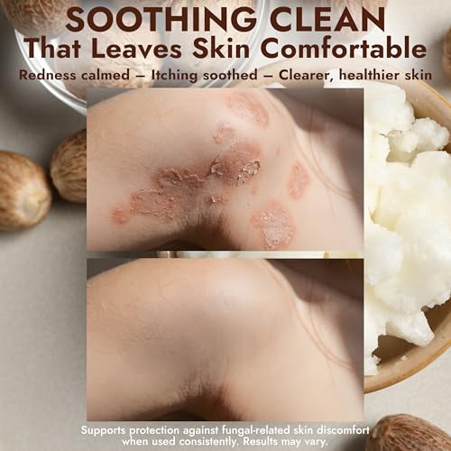 Image of Antifungal Soap Infused with Shea Butter 1% Tolnaftate for Deep Cleansing | Medicated Jock Itch Treatment, Helps Fight Ringworm & Athlete's Foot, for Deep Cleansing, 2 Antifungal Bars with Scrubber