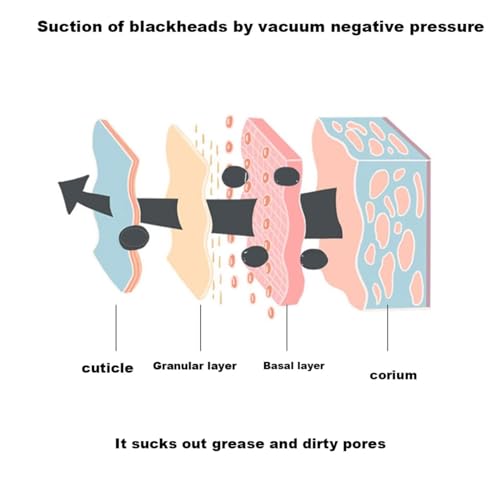 Luxury Confidence Keratin Remover Blackhead Remover Pore Vacuum Electric Face Vacuum Pore Cleaner White Heads Removal with 3 Modes and 4 Suction Heads Nose Hair Removal (Pink+White, One Size) - Image 7