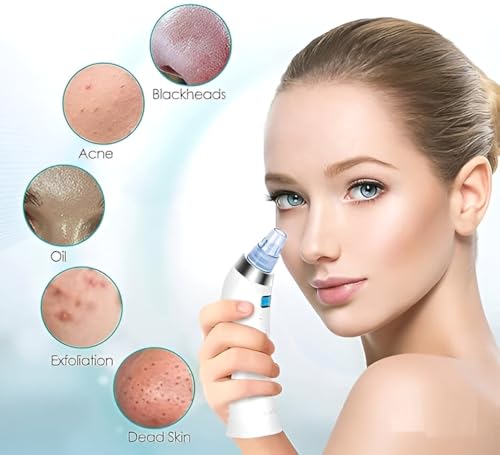 Image of Derma Suction Pore Cleaner - Blackhead Remover Vacuum Device with Suction Heads - Electric Facial Skin Cleanser for Acne, Oil & Dead Skin Removal - Gentle for All Skin Types (White 4 D Suction)