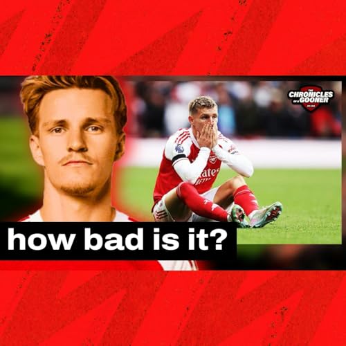 How bad is Odegaard's injury? Rice update & the Emirates Stadium atmosphere debate