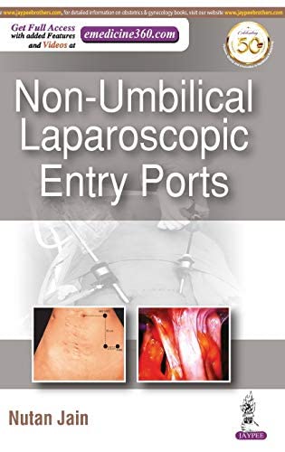 NON-UMBILICAL LAPAROSCOPIC ENTRY PORTS by Jain, Nutan
