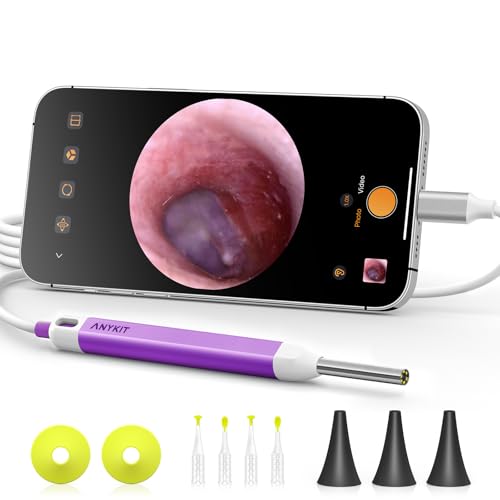 Anykit Digital Otoscope with Gyroscope – HD Ear Camera