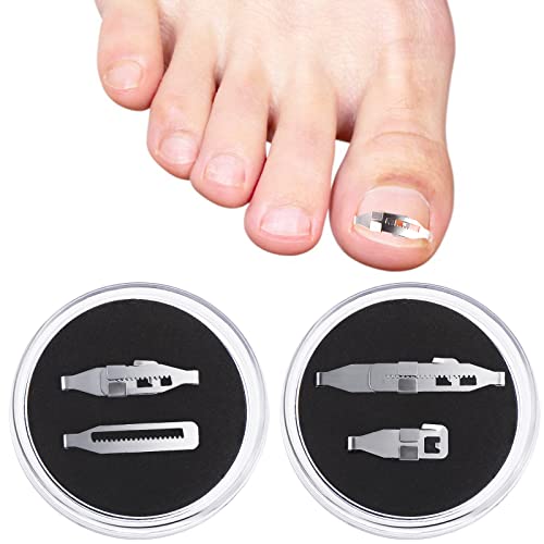4 Pcs Ingrown Straightening Clips Toenail Pedicure Tool Curved Brace Toenails Thick Paronychia Correction Tool, Ingrowing Nail Correctors, 2 Sizes