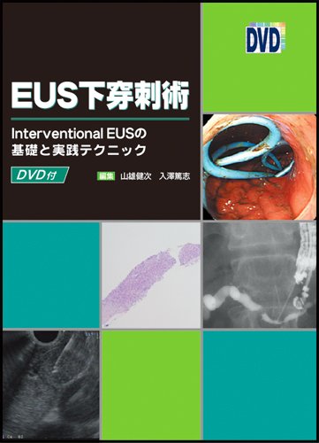 Amazon.co.jp: EUS下穿刺術 : 山雄 健次/入澤篤志: Japanese Books