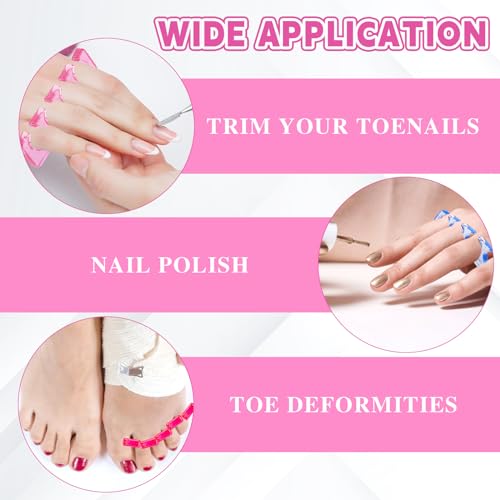 8Pcs Toe Separators for Pedicures, Silicone Toe Spacers for Women Men, Washable Toenail Dividers for Nail Polish/Toenail Trimming, Repeatable Toe Seperator for Separating Toenails