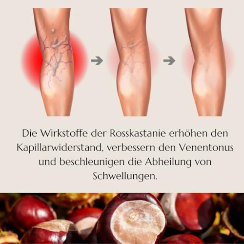 Green idea - ROSSKASTANIENÖL bei Krampfadern, Hämorrhoiden, Besenreiser, schwere Beine | Venenschatz | mit Rosskastaniensamen- und Blütenextrakt - Hämorrhoidenöl mit Rosskastanienextrakt 100 ml