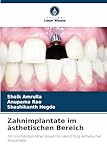 Zahnimplantate im ästhetischen Bereich: Ein multidisziplinärer Ansatz für den Erfolg ästhetischer Implantate