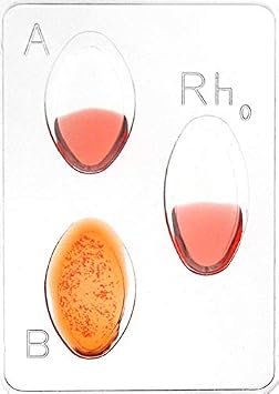 ALDON Innovating Science Genetics of Blood Type - Explore How Potential Inheritance Patterns, Genetic Expressions & Solve Simulated Paternity Dispute - Small Group Learning - Experiment Kit