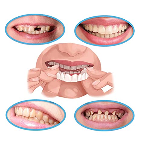 2 Pcs Dentures Teeth - Veneer Snap-In Teeth - For Temporary Tooth Repair Upper And Lower #TOP3