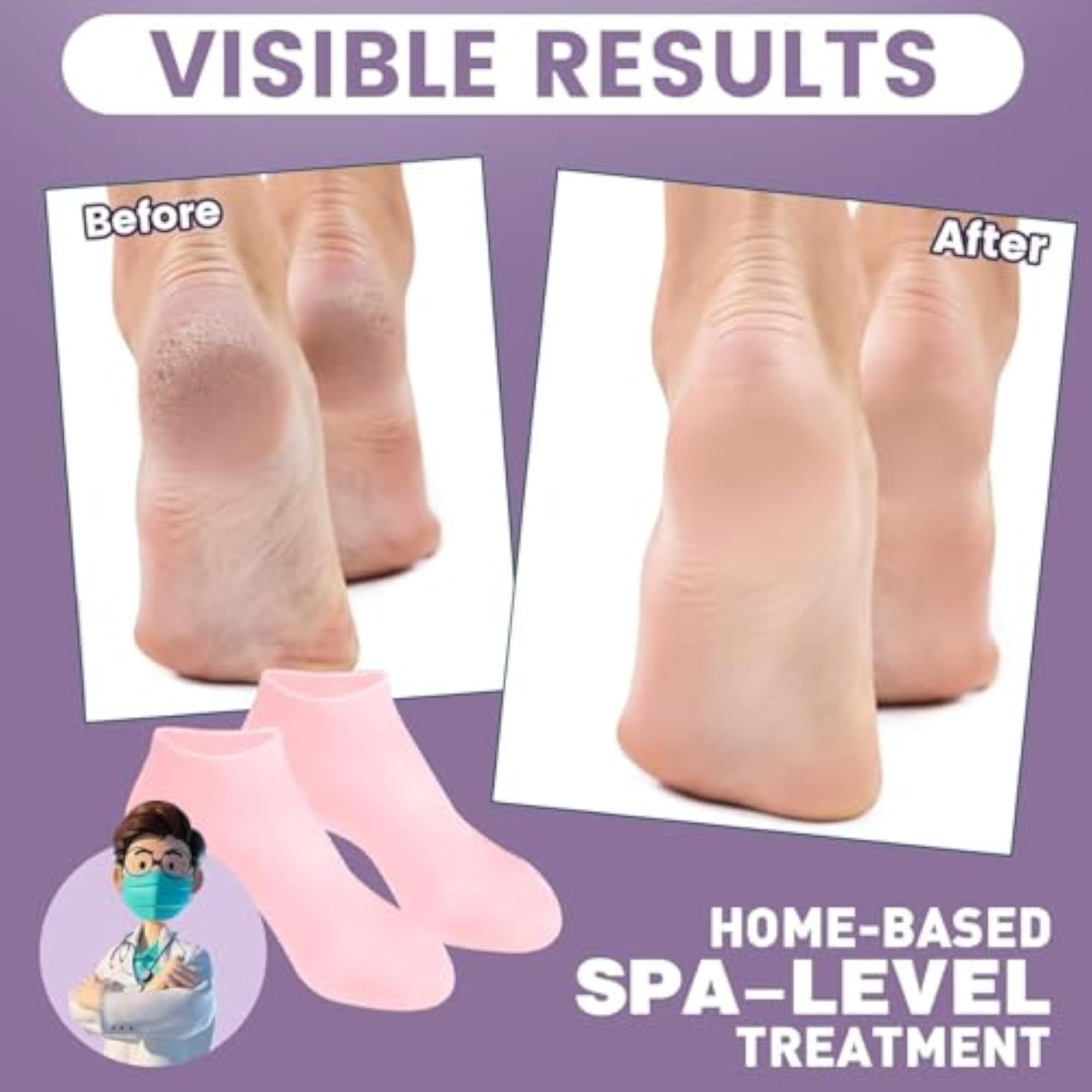 Silicone Gel Socks for Dry Feet, Moisturizing Foot Care