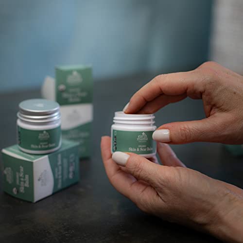 Earth Mama Organic Skin & Scar Balm | Comforts & Reduces Appearance Of Scars For Surgical Wounds + Pregnancy Stretch Marks, 1 Fl Oz #TOP6