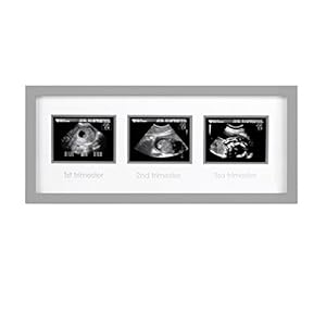 Pearhead Triple Sonogram Picture Frame, Pregnancy Keepsake Photo Frame, Gender-Neutral Baby Nursery Décor
