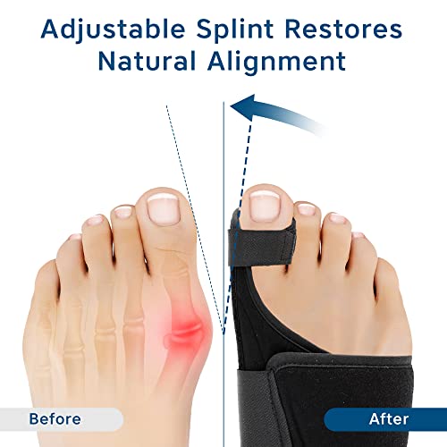 Zenhealth Bunion Corrector For Women & Men - Bunion Corrector Men Big Toe Brace, Bunion Splint Women Toe Corrector, Bunyon Fix Hallux Valgus Corrector Toe Brace Big Toe Straightener Bunyan Correct Bunion Relief #TOP1