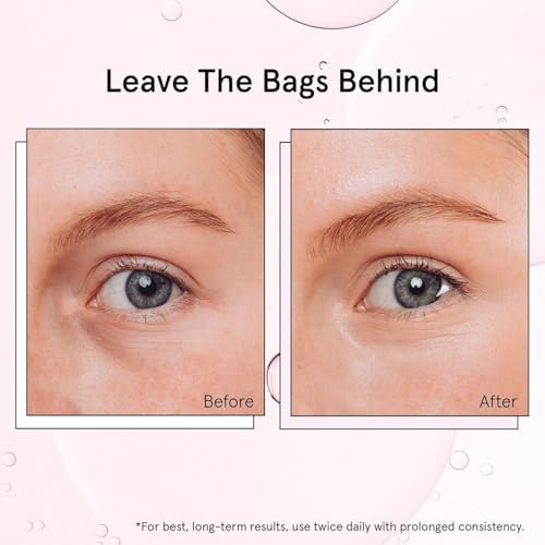 grace & stella Under Eye Brightener Roller - Airplane Travel Essentials - Travel Size Toiletries - Retinol & Caffeine Eye Serum for Puffiness, Dark Circles, Wrinkles - Vegan Skincare (15ml / 0.51floz) - 5