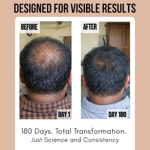 Image of Hair Growth Serum With 3% Redensyl, 6% Capixyl & 5% Anagain, Rosemary Oil for Density & Volume | Controls Hair Fall & Frizz | For Women & Men (30ml)