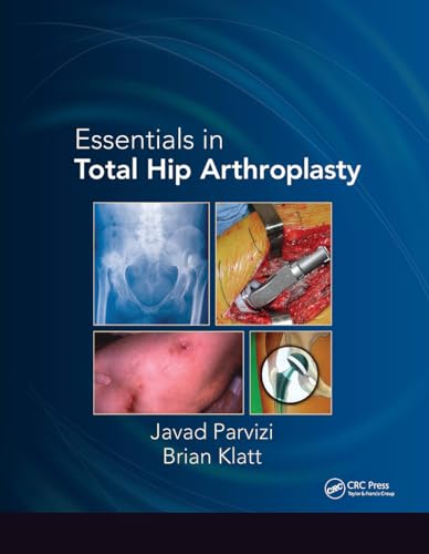 Essentials in Total Hip Arthroplasty view 2