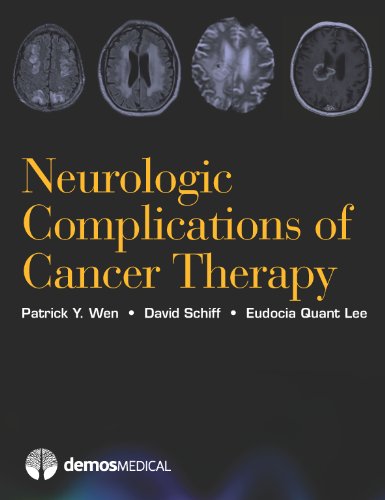Neurologic Complications of Cancer Therapy (English Edition)