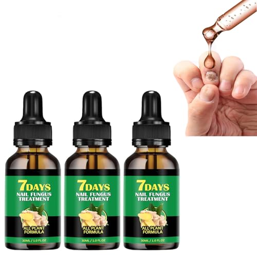 Tratamiento de uñas de jengibre,Tratamiento de Uñas con Jengibre, Aceite Fortalecedor para Uñas,tratamiento de uñas de 30 ml,suero de crecimiento de uñas de jengibre