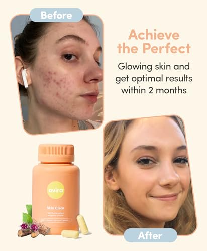Ovira Skin Clear with ZINCBRIGHT - 60 Capsules for Clear and Glowing Skin | Rosacea & Hormonal Acne Treatment | Support Collagen Production | Acne Supplements for Women & Men - Pack of 1 - Image 6