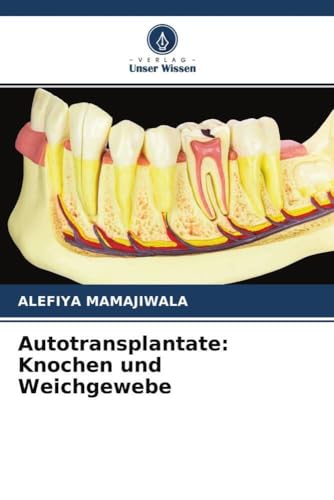 Autotransplantate: Knochen und Weichgewebe