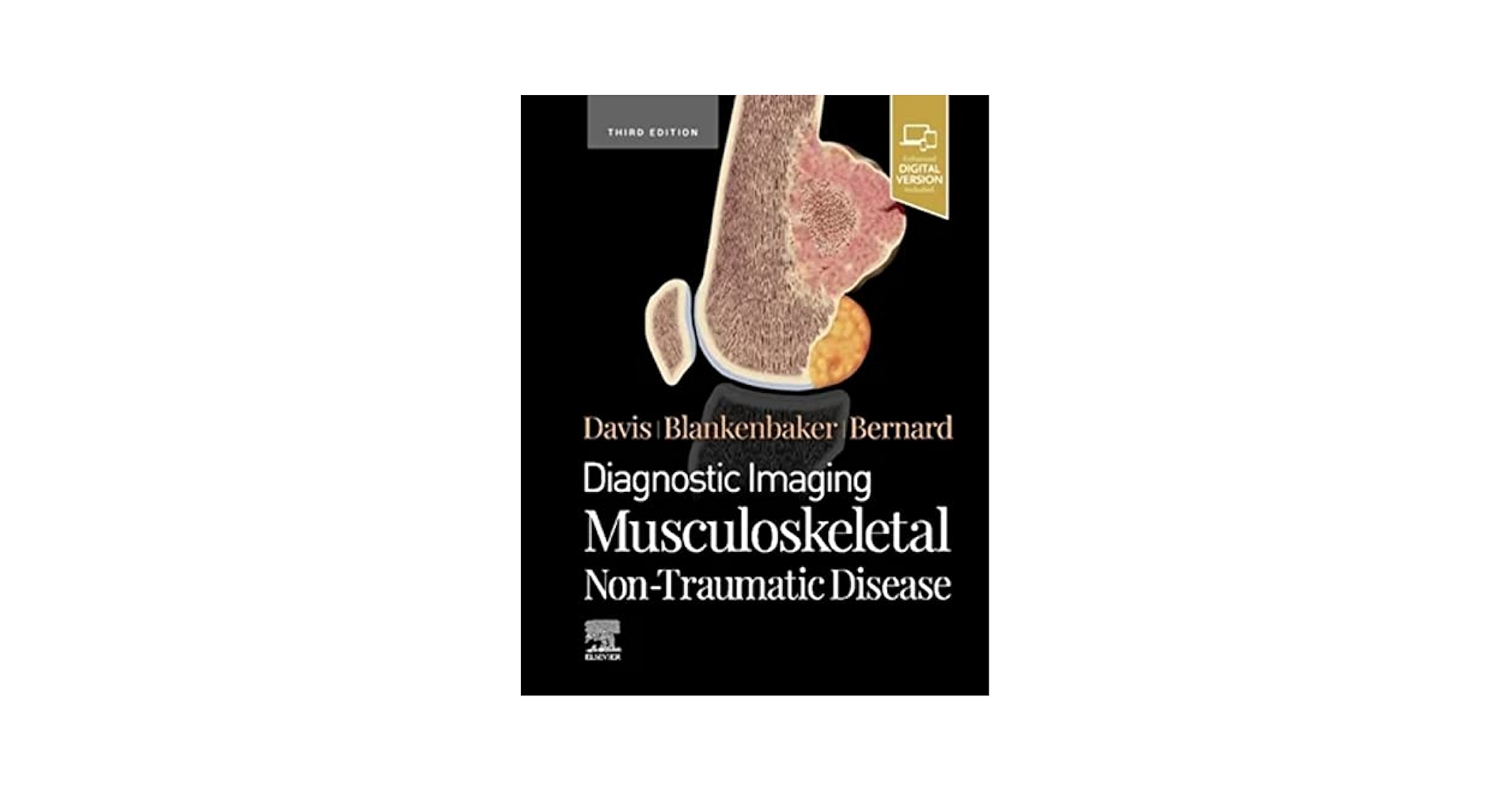 裁断済 Diagnostic Imaging: Musculoskeletal Diagnostic Imaging: Musculoskeletal Non-Traumatic Disease
