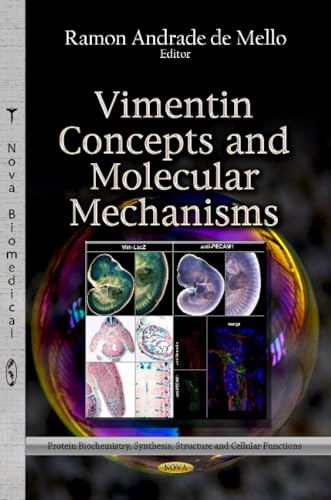 Vimentin Concepts and Molecular Mechanisms (Protein Biochemistry, Synthesis, Structure and Cellular Functions)