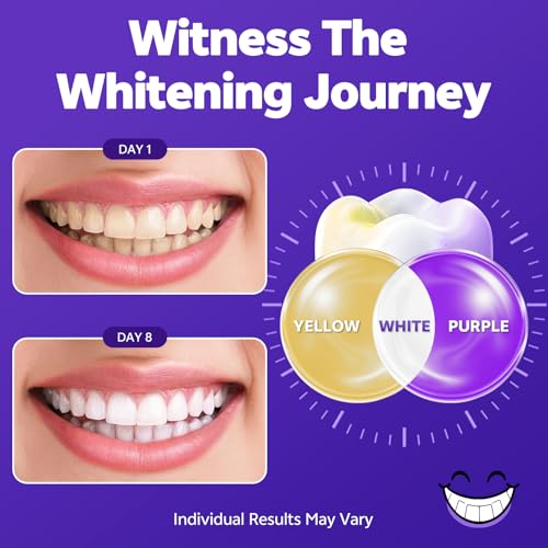 Image of Purple Teeth Whitening Strips, 14-Day Treatments Clinically Proven for Visible & Affordable Teeth Whitening, Enamel Care Whitening, Reduced Sensitivity Formula, Mint.