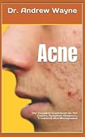 Acne: The Complete Guidebook On The Causes, Symptom, Diagnosis, Treatment And Management B0B93YXP95 Book Cover
