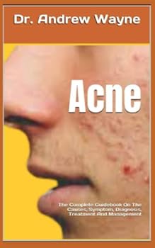 Paperback Acne: The Complete Guidebook On The Causes, Symptom, Diagnosis, Treatment And Management Book