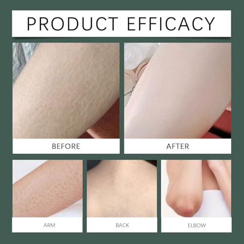 IFSLQNX Collagen Lifting Body Cream, Anti Aging Skin Firming and Tightening Cream, Hydrating Moisturizer for Dry Skin and Fine Lines, Lightweight Non Greasy (1PCS)