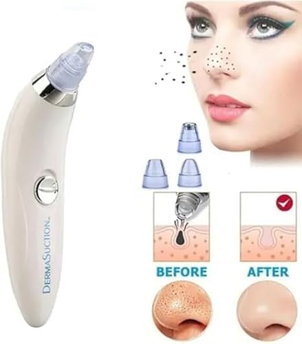 Removedor de Cravos e Espinhas Elétrico USB, Sugador Facial, Branco