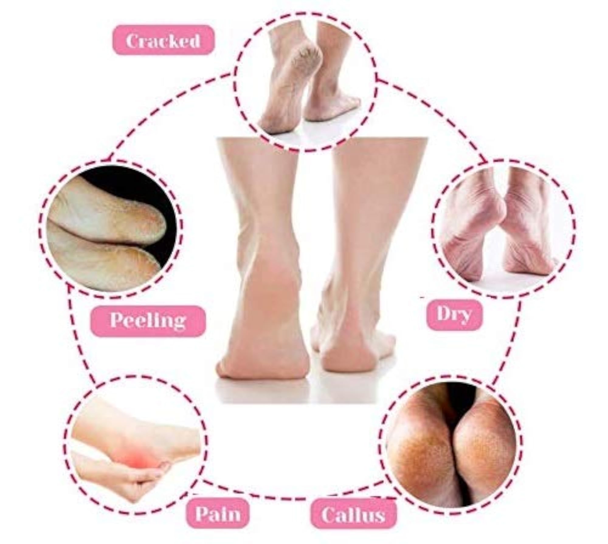 Heel Pain Relief Silicone Gel Heel Socks, Protector