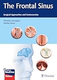 The Frontal Sinus: Surgical Approaches and Controversies