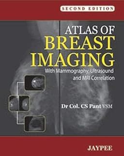 Atlas of Breast Imaging with Mammography, Ultrasound and MRI Correlation