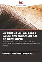La dent sous l'objectif: Guide des coupes au sol en dentisterie (French Edition) 6202471409 Book Cover