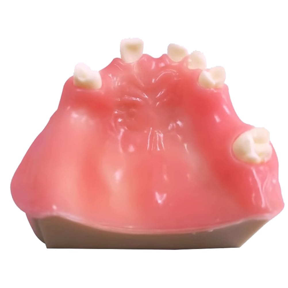 Modèle d'implant Dentaire Modèle éducatif de Dents Modèle Anatomique de dent pour l'étude et l'enseignement