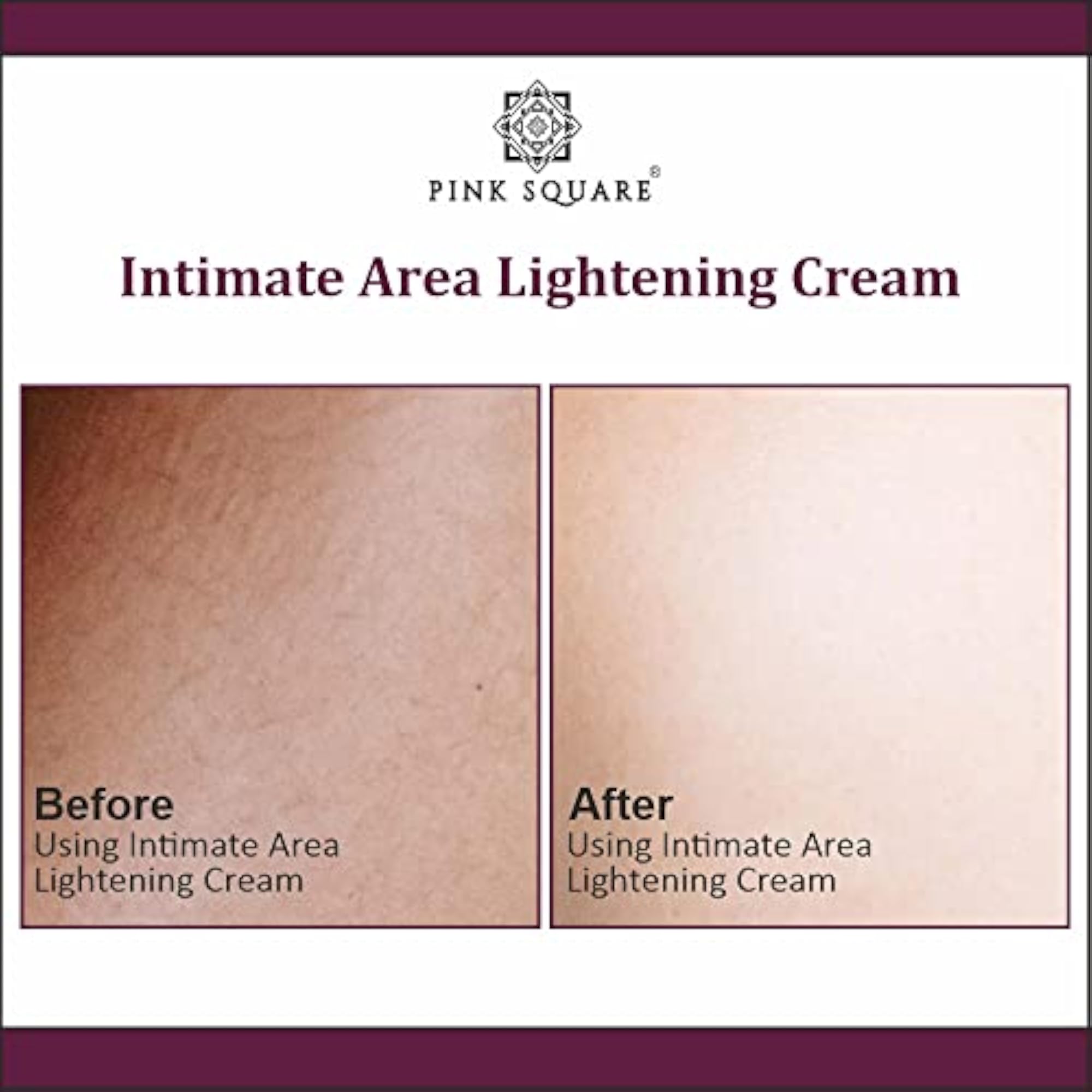 Intimate Area Skin Lightening Cream, 100g